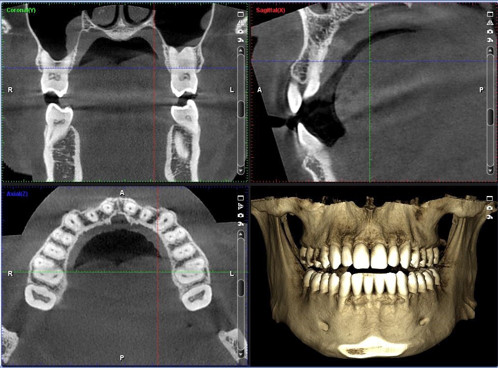 i-cat 3d image