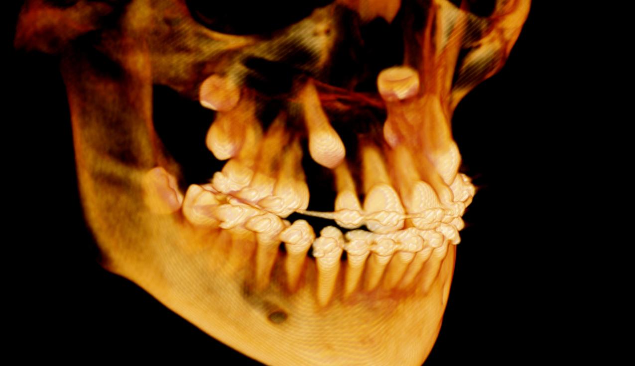 3d image of mouth