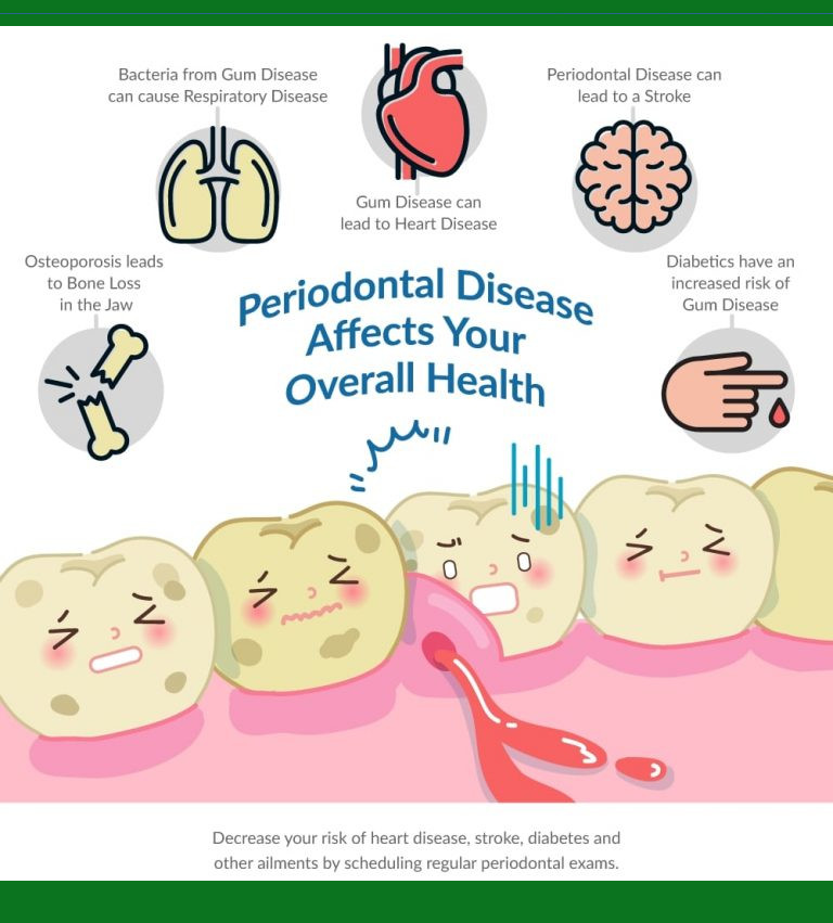 periodontal disease infographic