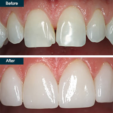 Cosmetic Dentistry Image